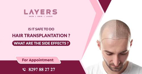 Hair transplantation Hyderabad