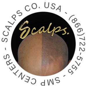 SCALPS | Scalp Micropigmentation Centers